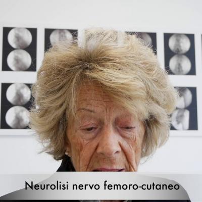 Compressione del Nervo Femoro-cutaneo Laterale
