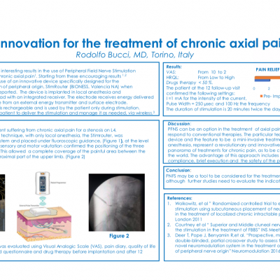 Innovazione per il trattamento del dolore assiale cronico