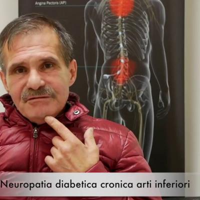 Neuropatia Diabetica Cronica Arti Inferiori